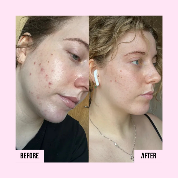 Medicube | PDRN Pink Collagen Capsule Cream