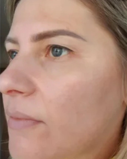 Na