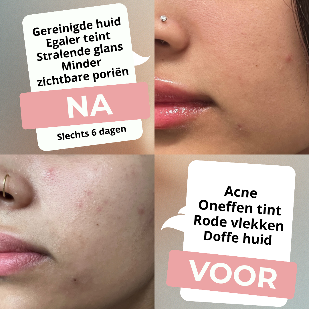 Anua | Ultieme Skincare Routine