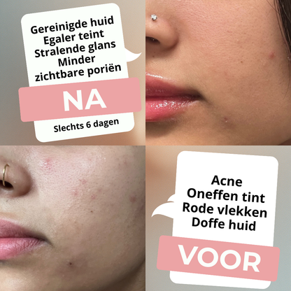 Anua | Ultieme Skincare Routine