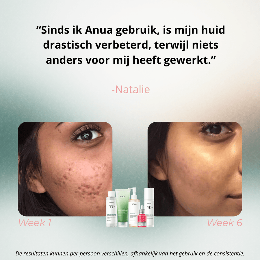Anua | Ultieme Skincare Routine - Glow House
