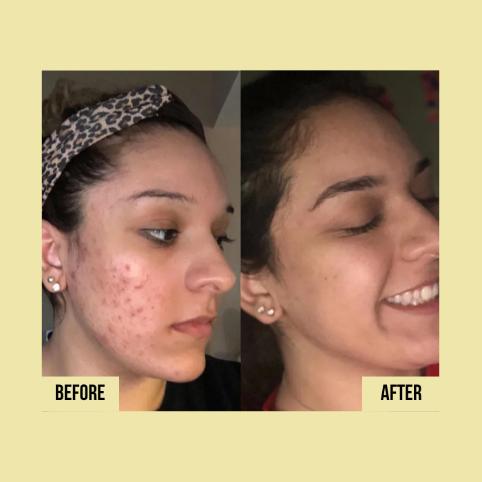 Medicube | Vitamin C Capsule Cream