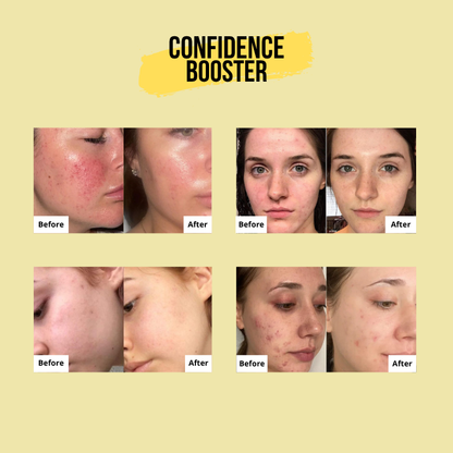 Medicube | Vitamin C Capsule Cream