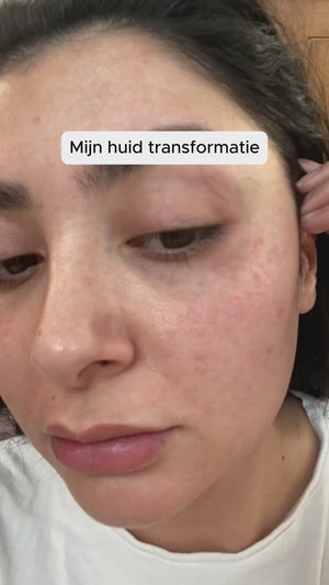 Freya, 29