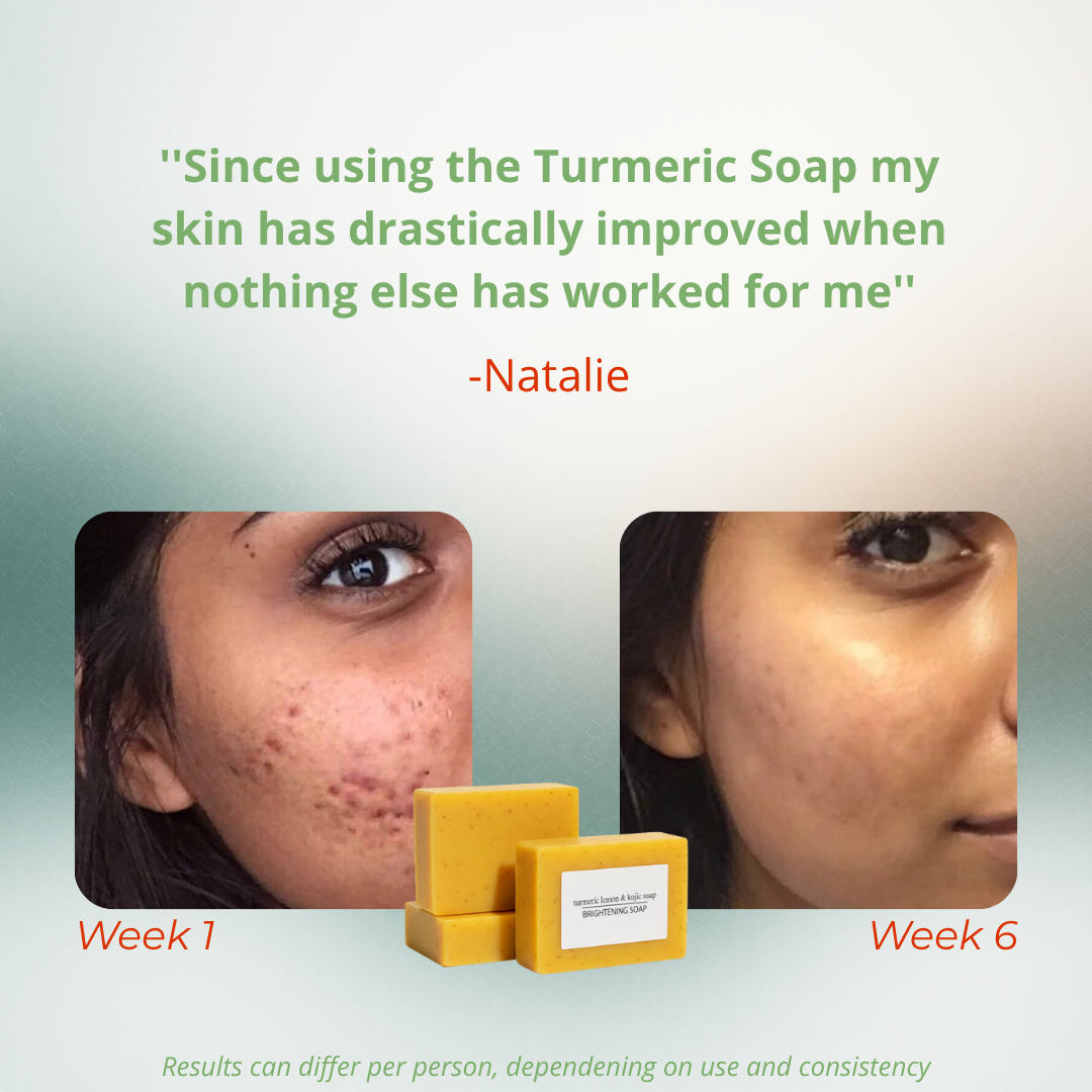 Turmeric, Lemon & Kojic acid soap