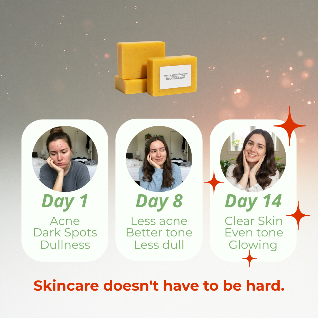 Turmeric, Lemon & Kojic acid soap